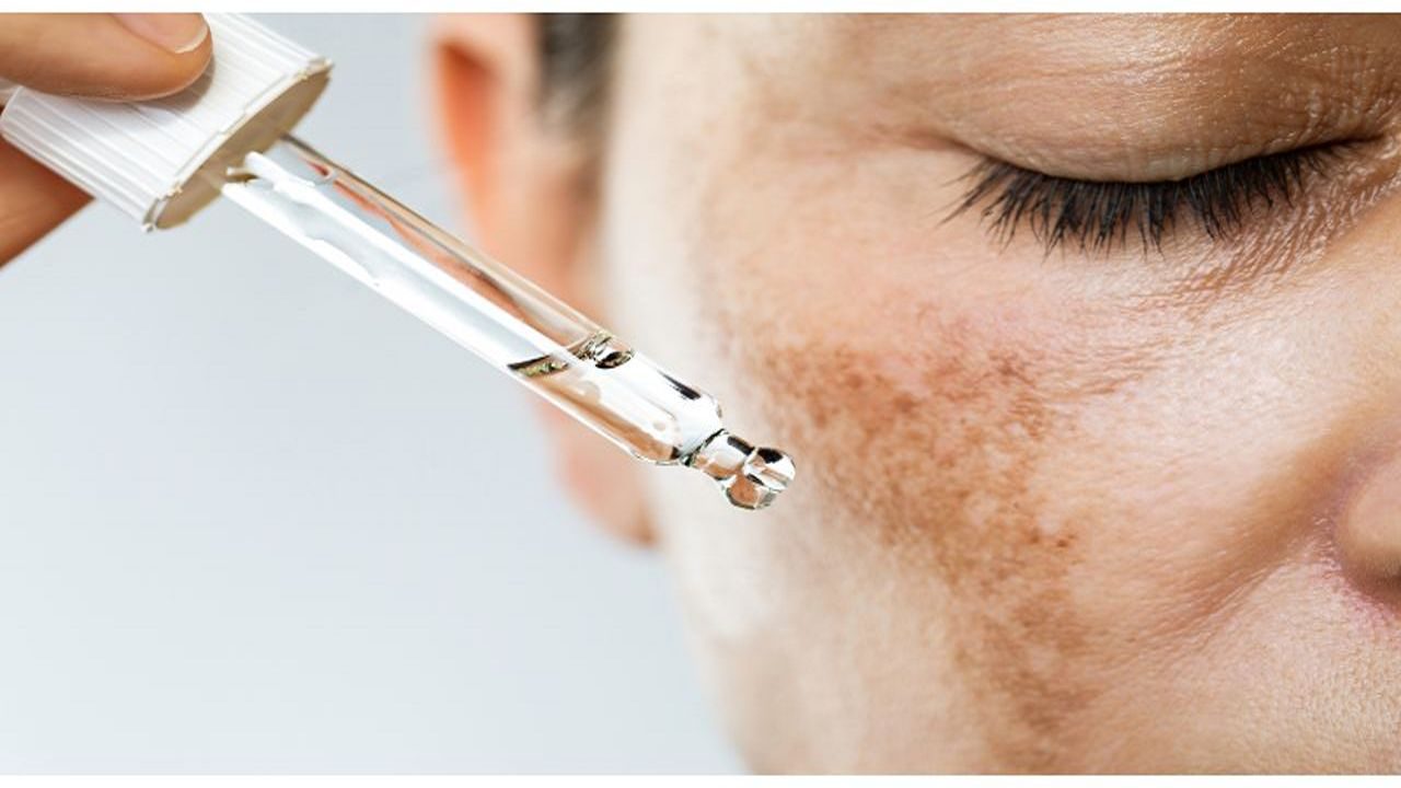 Proven Topical Therapies and How to Use Them